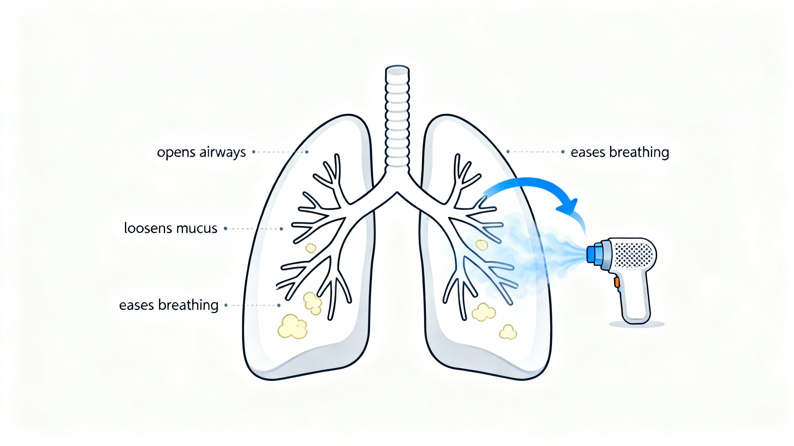 Mist from a handheld mesh nebulizer flowing into human lungs with labels: opens airways, loosens mucus, eases breathing